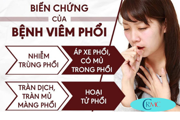Biến Chứng Nguy Hiểm Của Viêm Phổi