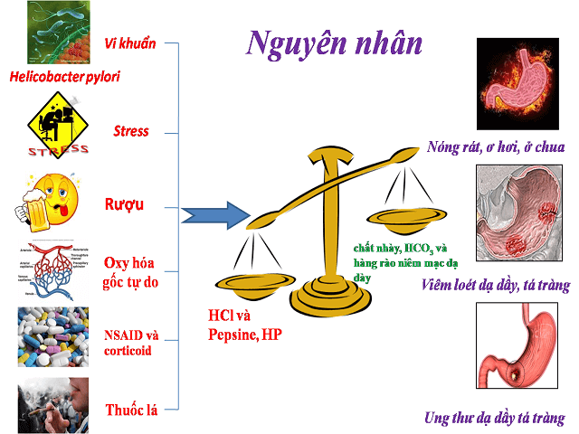 Nguyên Nhân Gây Ra Bệnh Ung Thư Dạ Dày